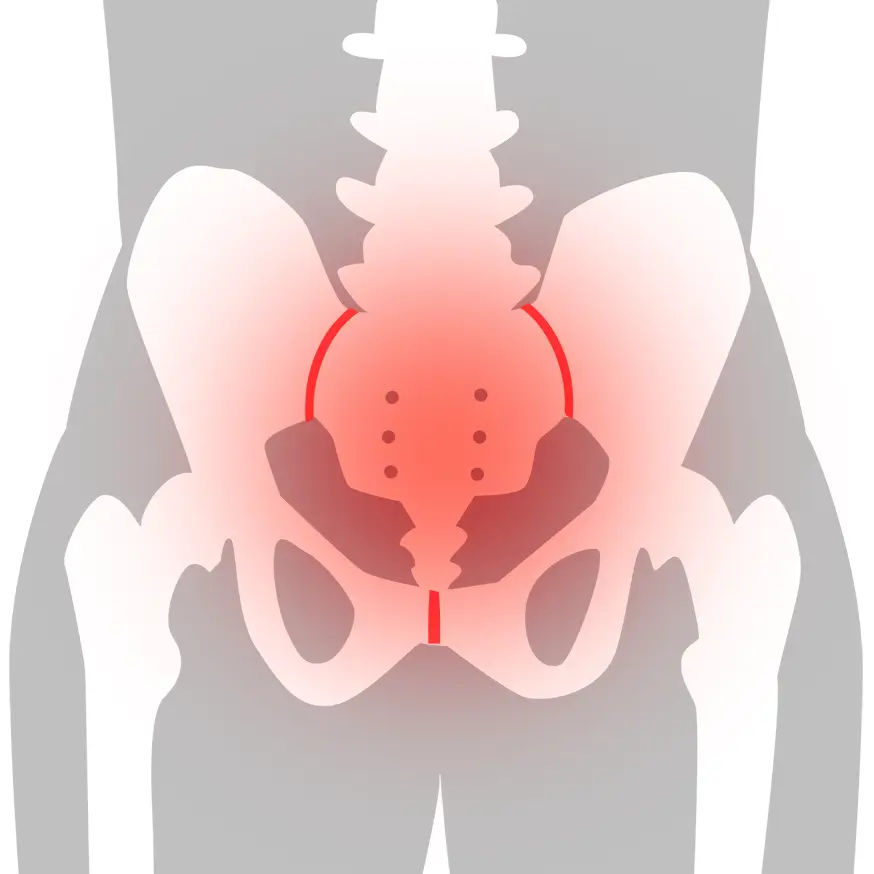 Bäckensmärta orsakad av foglossning, vanligt under graviditet och behandlas på Hisingen