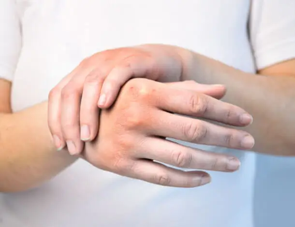 Smärta i handleden vid rörelse, vanligt besvär som behandlas hos kiropraktor i Göteborg